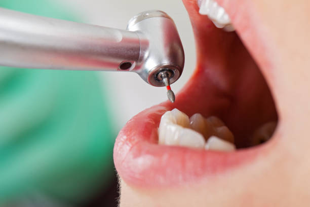 Best Cracked Tooth Emergency Dentist  in Toquerville, UT